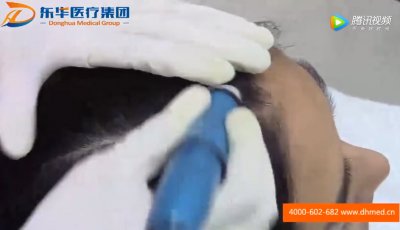 润氧秀·小分子水—头皮管理操作视频